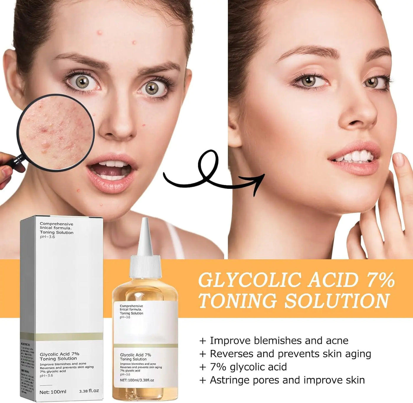 240ML Glycolic Acid 7% Toner,Glycolic Sour 7% Toning,KeepThe Skin Moist,Exfoliate, Exfoliating Serum for Face,Hydrates and Reduces Skin Blemishes (8.12 f.oz)